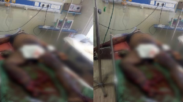 ऑक्सीजन सिलेंडर फटने से एक दुकानदार की मौत, एक अन्य बुरी तरह झुलसा 1 Hello Uttarakhand News »