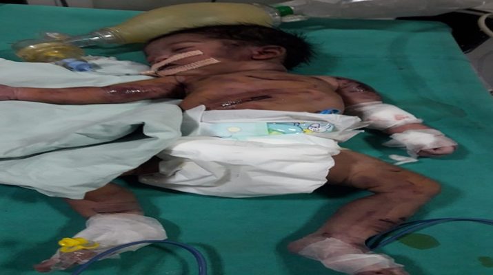 नवजात शिशु बिंदाल नदी में मिलने से सनसनी, बच्ची की हालत नाज़ुक 1 Hello Uttarakhand News »