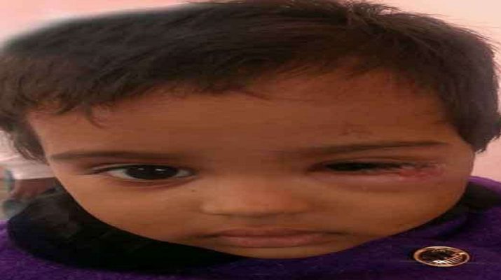 नशे में धुत पति ने पत्नी को पीटा, मासूम बेटी की आँख में दागी जलती बीड़ी 1 Hello Uttarakhand News »