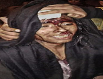 जेएनयू हमला: NUSU की अध्यक्ष बोली पूरी प्लानिंग से किया हमला, ABVP बोली उनका कोई छात्र नही है शामिल 6 Hello Uttarakhand News »