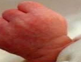 ऋषिकेश: ऑटो में रोती हुई मिली नवजात बच्ची, हालत गंभीर 4 Hello Uttarakhand News »